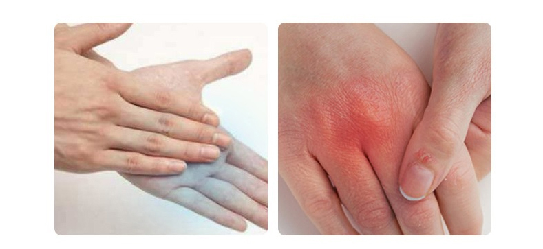 Masajeador de manos infrarrojo